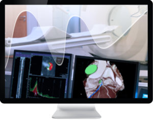 Medis Suite CT image on monitor