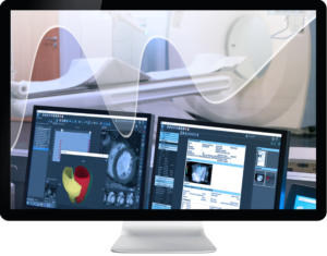 Medis Suite MR image on monitor