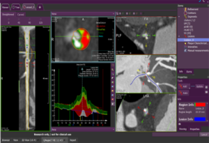 Medis Suite CT Research Apps