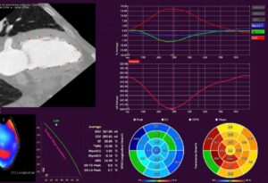 Medis Suite CT Research Apps
