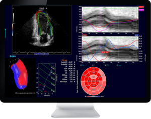 Ultrasound screen 2