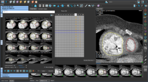 Medis Suite CT – LV/RV Function photo illustration