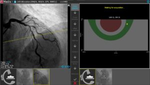 Medis Suite XA 3D QCA Single Vessel 1 Series Selection