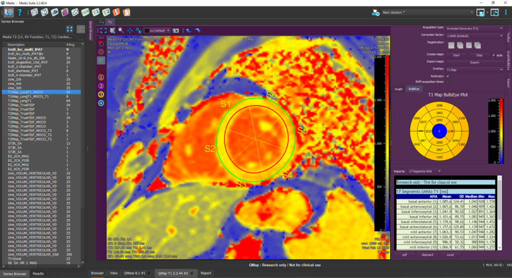 Medis Suite MR Research application T1 Mapping Module 2