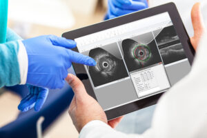 Medis Suite Intravsacular image on tablet