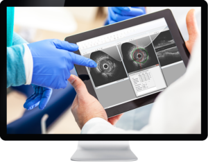 Medis Suite Intravsacular image on tablet on monitor