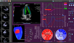 Echo image for website