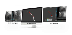 QFR image mockup 3 screens