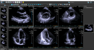 Medis Ultrasound viewer