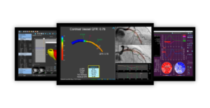 An image of the software solutions of medis