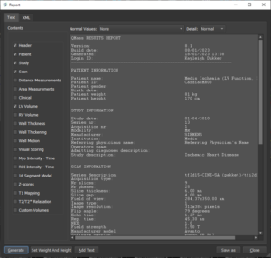 Screenshot of the Report pop-up in QMass